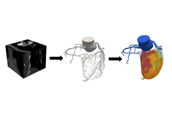 Cardiac digital twin model created from medical image data showing coronary arteries and simulation of blood flow into heart muscle.  Photo credit: Charles Taylor, Oden Institute for Computational Engineering & Sciences at The University of Texas at Austin.
